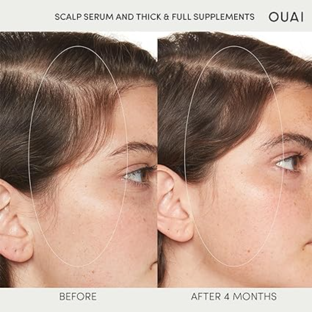 OUAI Scalp Serum 60ml